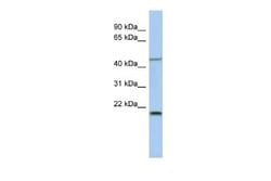 KLF15 Rabbit anti-Human, Polyclonal, Novus Biologicals 0.1ml; Unconjugated:Antibodies,
